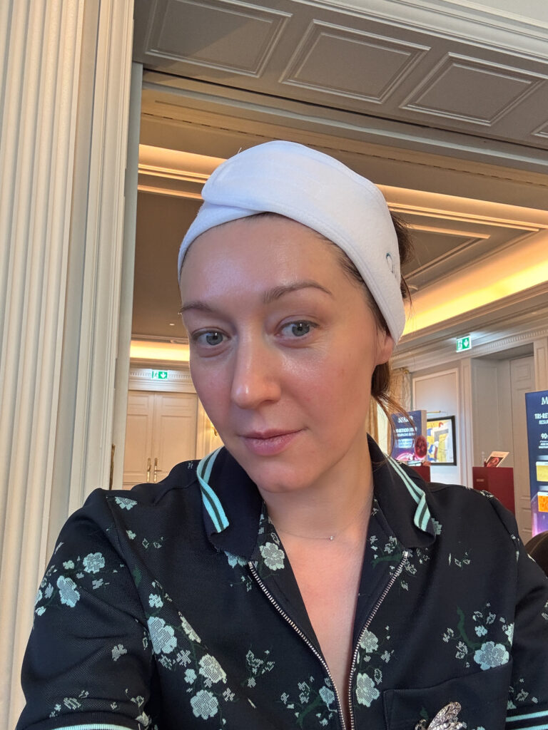 Yuliia Caliskan after the MIAMO treatment, looking to the side with fresh, even skin